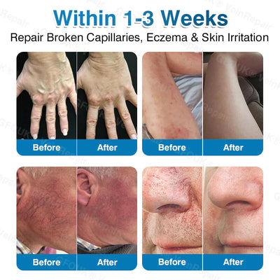 PatchRoll - Microneedling Patch Roll