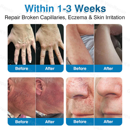 PatchRoll - Microneedling Patch Roll