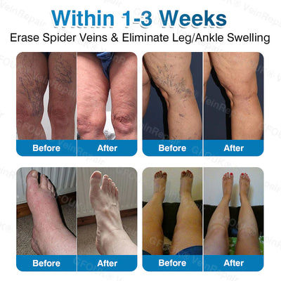 PatchRoll - Microneedling Patch Roll