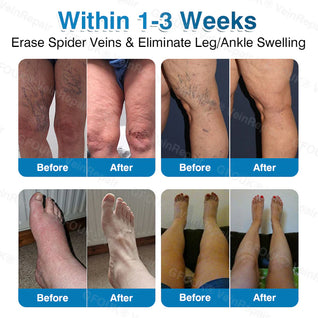 PatchRoll - Microneedling Patch Roll