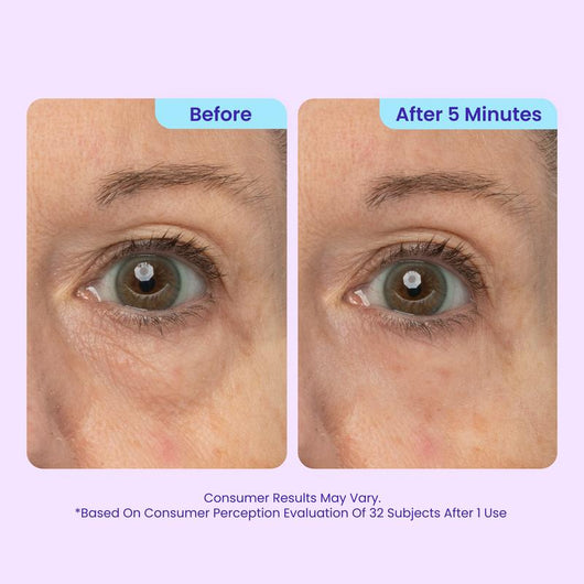 The 5-Minute Eye Lift Gel