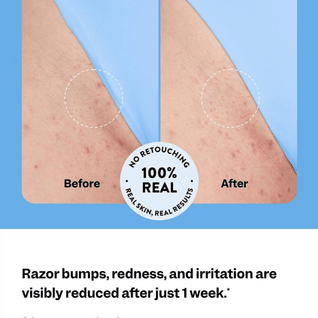 Malyora™️ Smoothing Serum
