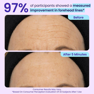 The 5-Minute Eye Lift Gel