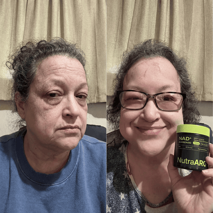 NAD+ Liposomal: Lucí y Sentite 10 Años Más Joven, Sin Botox
