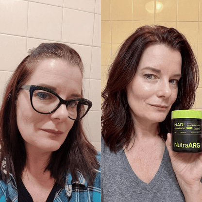 NAD+ Liposomal: Lucí y Sentite 10 Años Más Joven, Sin Botox