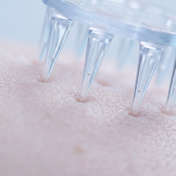 Microneedle Transdermal Delivery